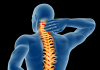 The Latest on Treating Degenerative Disc Disease Degenerative Disc Disease Treatment