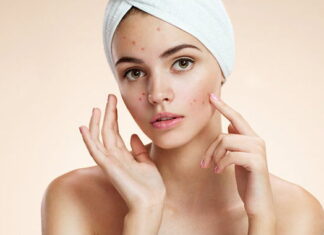Acne: When does it appear, factors and treatment options