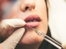 Exploring the Precision of Laser Treatments in Plastic Surgery woman holding pen and white cotton candy