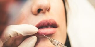 Exploring the Precision of Laser Treatments in Plastic Surgery woman holding pen and white cotton candy